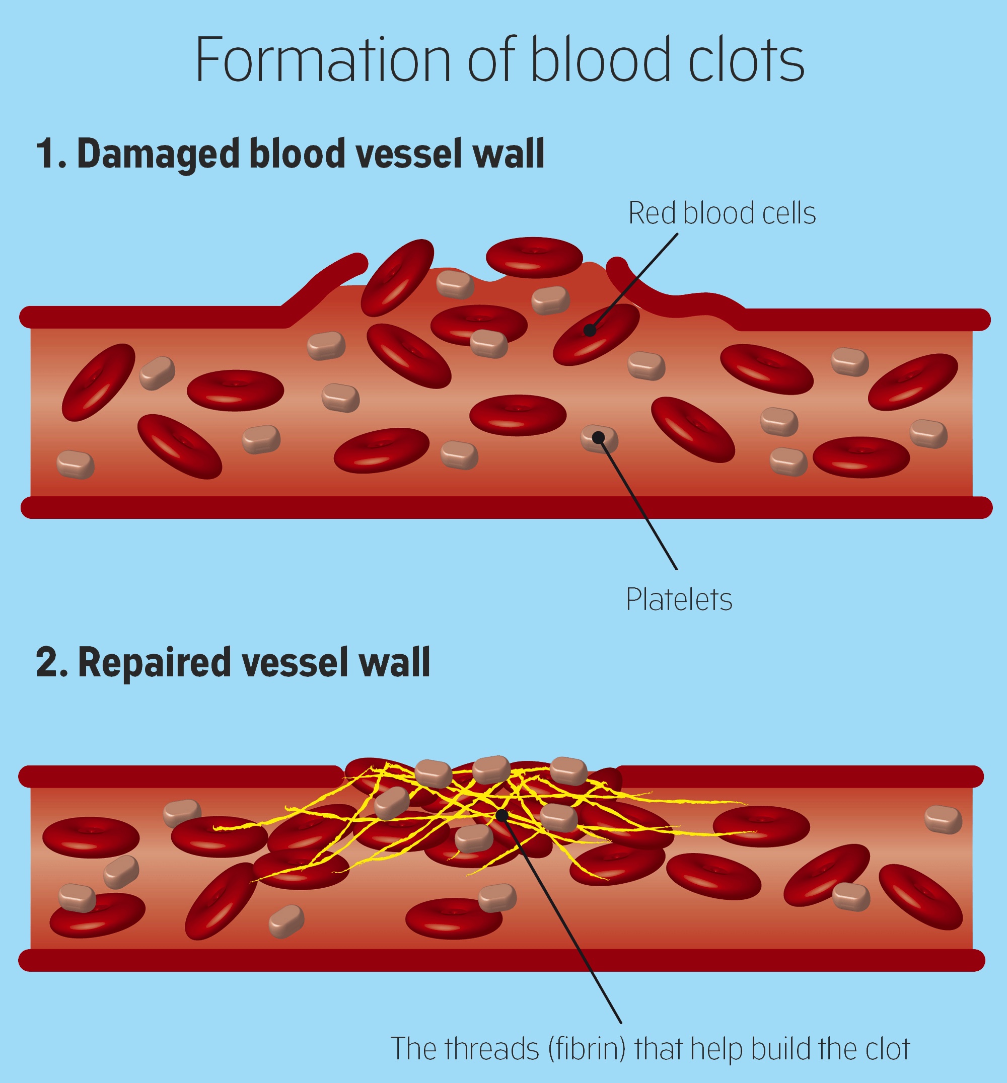 Blood case