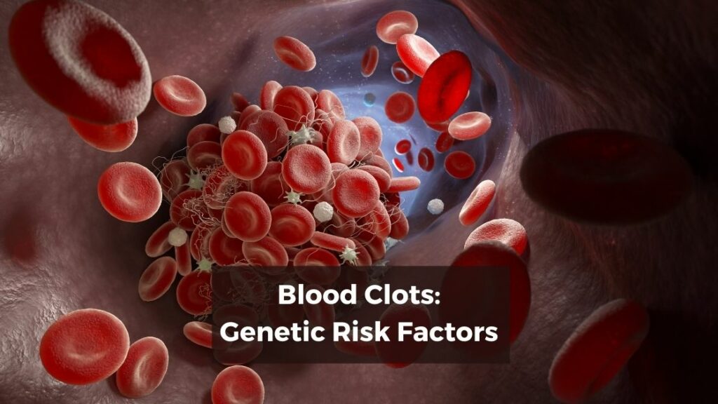 7 variants that increase your risk of blood clots