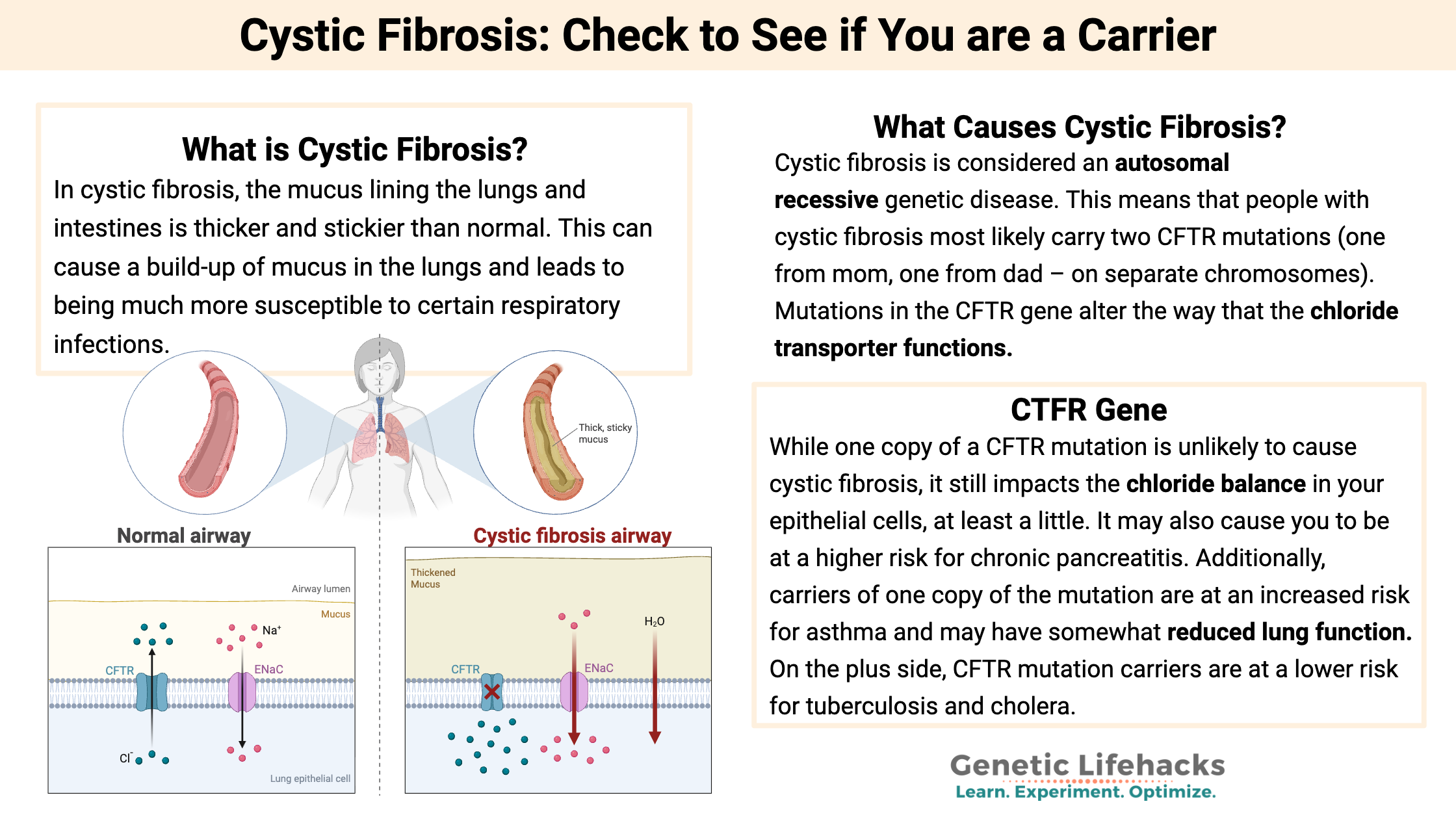 Cystic Fibrosis: Check to See if You are a Carrier