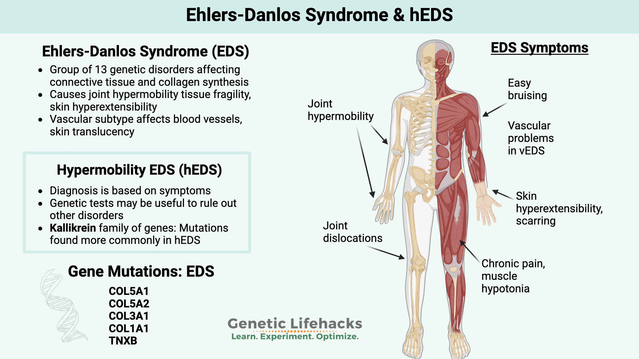 Vascular Ehlers Danlos Syndrome 748x1000